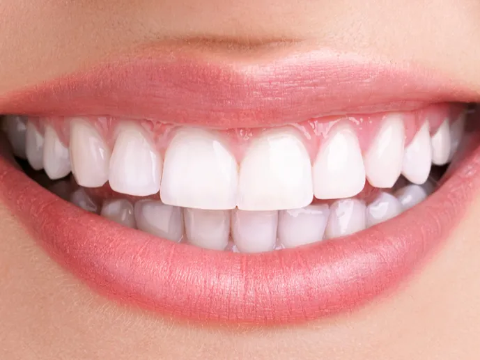Close-up of a healthy, bright white smile.