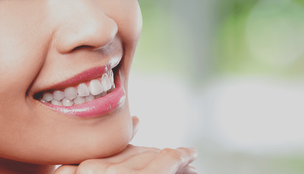 whitened teeth